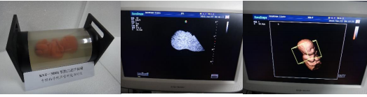 KST-3D01 3D Fetal Ultrasound Phantom Amniotic Fluid Environment Model