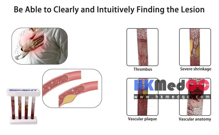 Blood Vessel Contrast Demonstration Kit,Vascular Disease Simulation Model