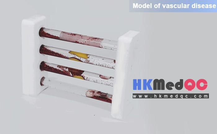 Blood Vessel Contrast Demonstration Kit,Vascular Disease Simulation Model