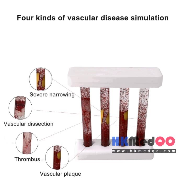 Blood Vessel Contrast Demonstration Kit,Vascular Disease Simulation Model