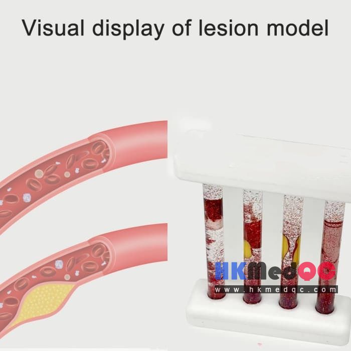 Vascular Pathology & Blood Flow Simulation Model