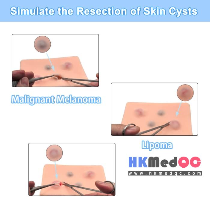 Dermatology Procedure Practice Model,Lipoma & Cyst Practice Module