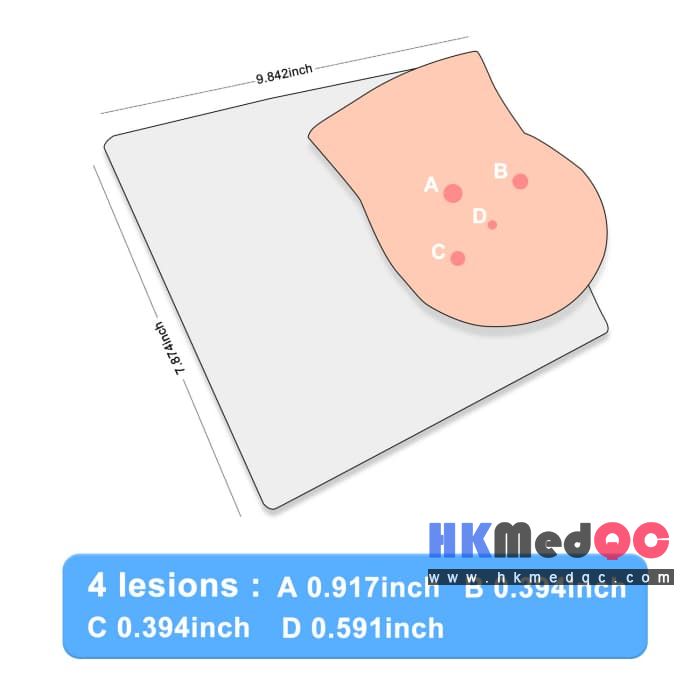 Breast Lesion Palpation Model,Breast Medical Education Model