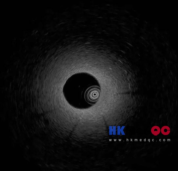 KS107QN-4A Endoluminal & Interventional Ultrasound Tissue Mimicking Phantom